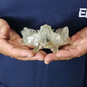 Planejamento + Biomodelo 3D Transparente